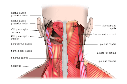 best doctor for Neck Pain in sonipat