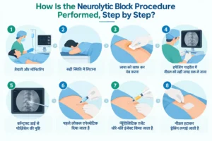 How Is the Neurolytic Block Procedure Performed, Step by Step